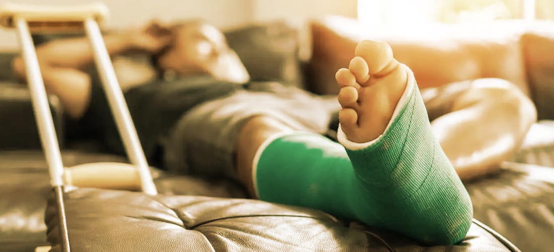 Man laying on couch with cast on broken ankle